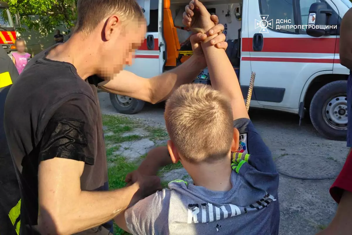 У Кам’янському 10-річний хлопчик напоровся рукою на штир паркану: знадобилася допомога ДСНС